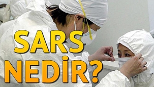 Sars virüsü nedir, belirtileri nelerdir?