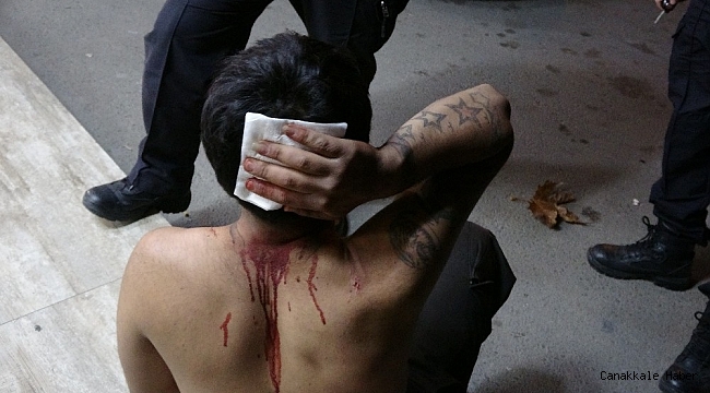 Başına çivili sopa ile vurulan yaralıyı ambulansta linç etmeye çalıştılar