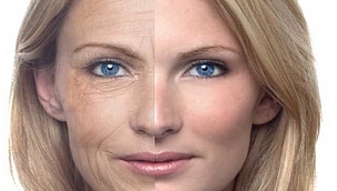 Cilt yaşlanmasını önleyebilmek mümkün