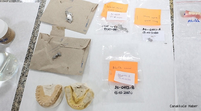 Dokuz Eylül&#039;den diş protezi analizi için yerli referans malzeme