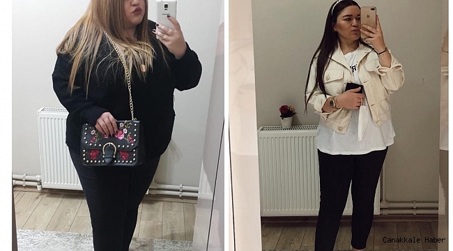 Mide küçültme ameliyatı ile 9 ayda 58 kilo verdi