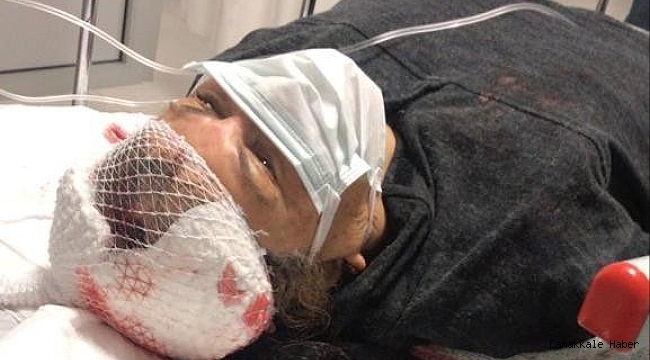 Muğla&#039;da köpeklerin saldırısına uğrayan emekli öğretmen ağır yaralandı
