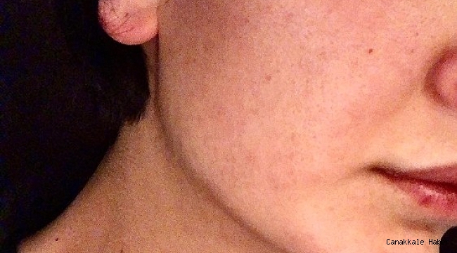 Oyuncu Sevcan Yaşar&#039;ın darp edilmesine ilişkin fotoğraflar dava dosyasına girdi