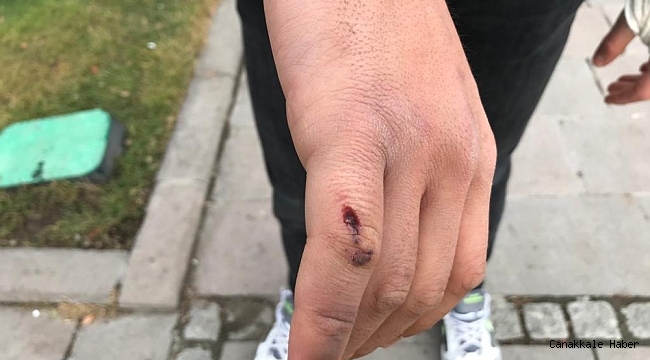 &quot;Canım acıdı&quot; denilerek darp edilen sağlıkçı o anları anlattı