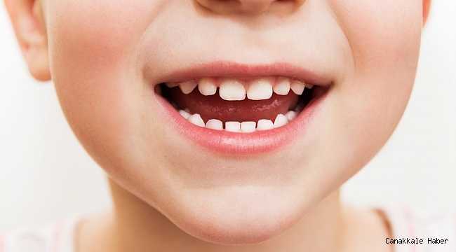 Süt dişi çürükleri tedavi edilmeli