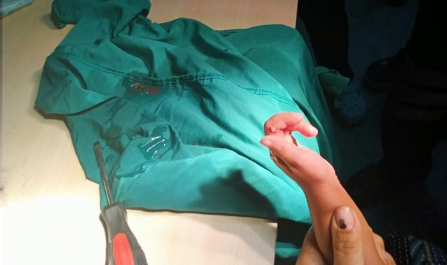 Parmağı korkuluğa sıkışan çocuğu AFAD ve itfaiye ekipleri kurtardı