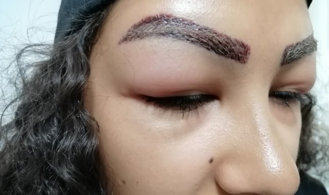 Reklam yüzü olmak için gitti, yüzünden oldu