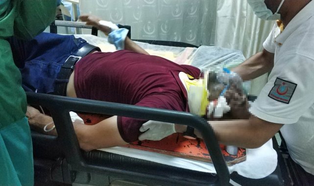 Samsun&#039;da trafik kazası: 1 yaralı