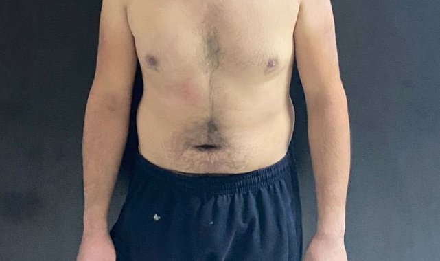 Altındağ'daki bıçaklı saldırının zanlıları tutuklanarak cezaevine gönderildi