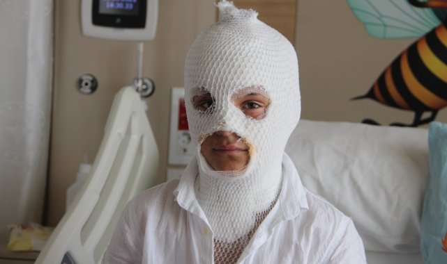 Camide çıkan yangını söndürmeye çalışırken kendisi yandı