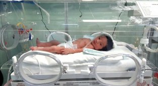 Canlı canlı gömülen bebeğin sağlık durumu iyi