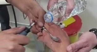 Elazığ'da itfaiyeden yüzük çıkarma operasyonu