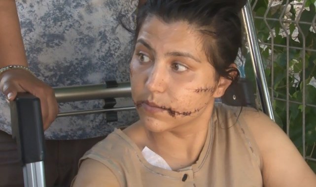 Eşinin banyoya kilitleyip 100 yerinden bıçakladığı kadın o anları anlattı