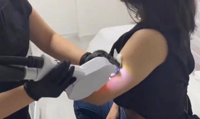 Lazer epilasyon ile istenmeyen tüylere kalıcı çözüm