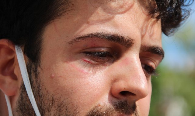 Sokakta köpeklerini gezdiren üniversite öğrencisine saldırı