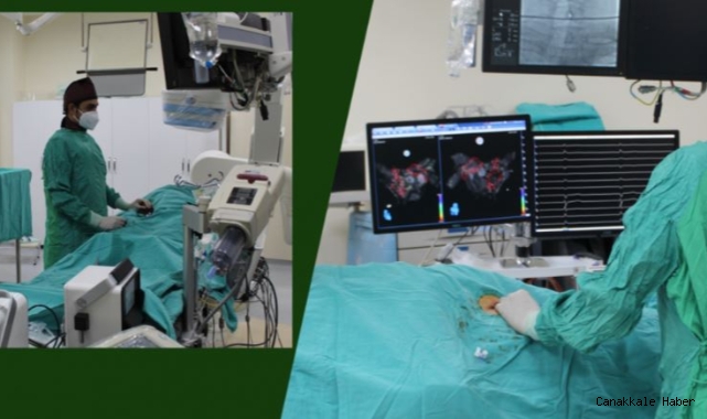 Ablasyon tedavisi başarıyla uygulanıyor