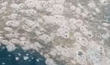 Müsilaj tedirginliği