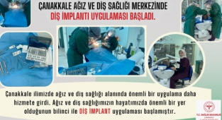 İmplant uygulaması başladı